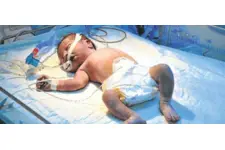 Bebeklerde Kasık Fıtığı Ameliyatı