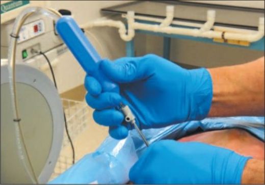 Bel Fıtığı İğnesi Kullanımı ve Faydaları Nelerdir?